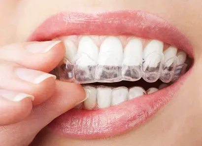 Zahnschiene vom Zahnarzt